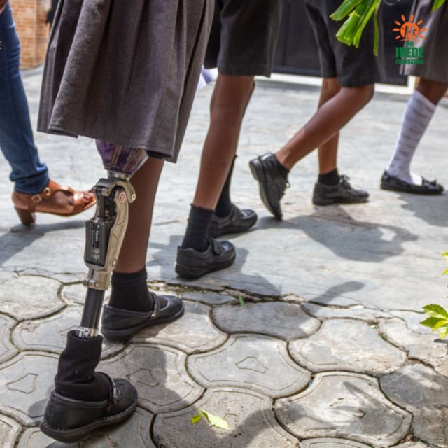 Nigerian woman recycles prosthesis so amputee children walk again