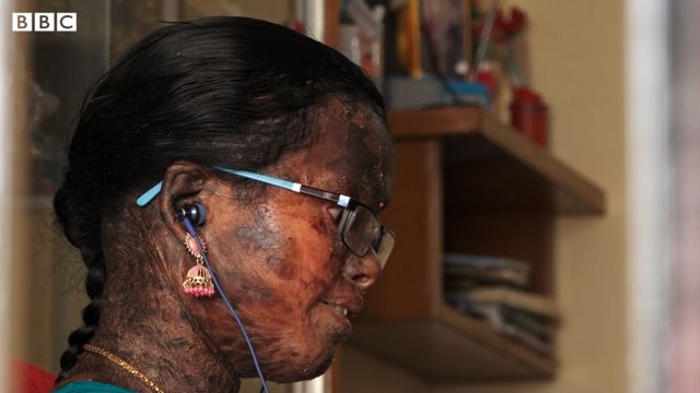 மதுரை, பார்கவி