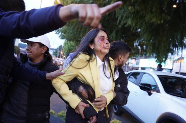 Mujer herida en medio del asalto a Fernando Villavicencio