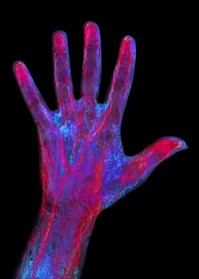 Imaging of an outstretched hand