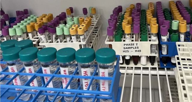 صورة لتحاليل طبية