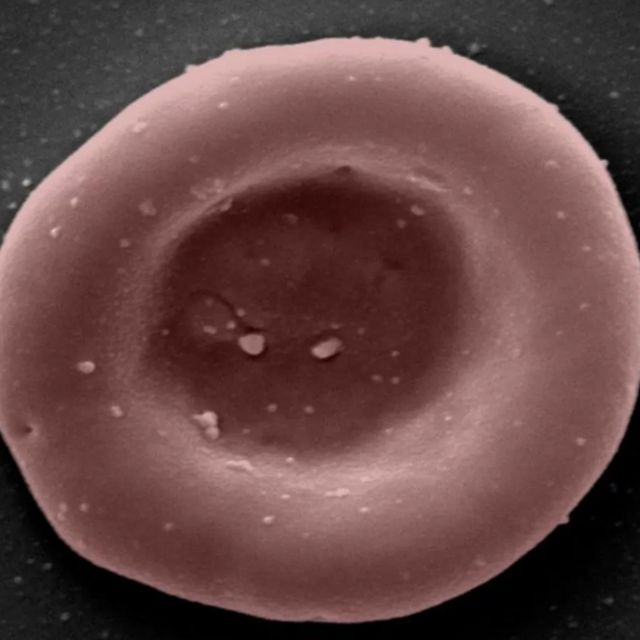 Laboratuvarda üretilmiş bir kırmızı kan hücresi