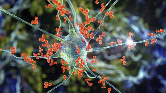 Imagen de una neurona en un montaje. 
