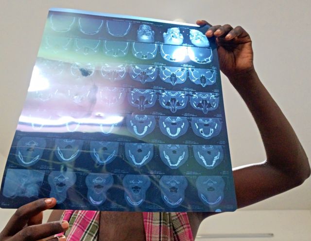 நெல்லை பட்டியலின இளைஞர்கள் தாக்கப்பட்ட விவகாரம்