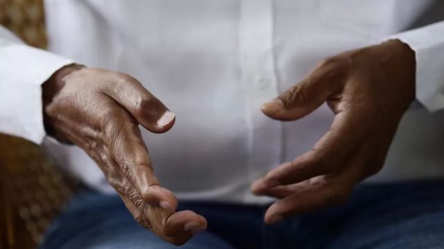 It took doctors 16 hours to perform surgery to repair his arms, hands and fingers.