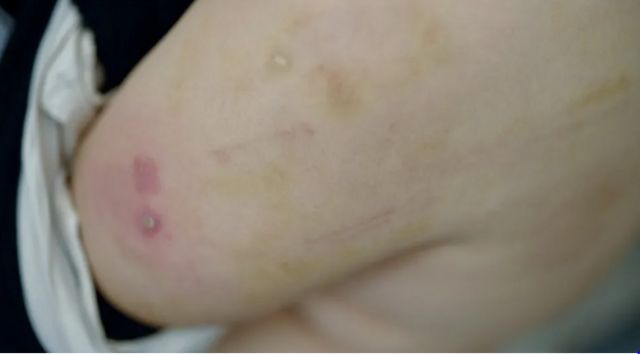 தாக்கப்பட்ட பாலஸ்தீன கைதிகள்