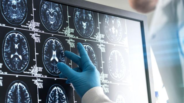 பெருமூளை வாதம், குழந்தைகள், உடல்நலம், மருத்துவம்