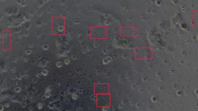 விந்தணுக்கள்