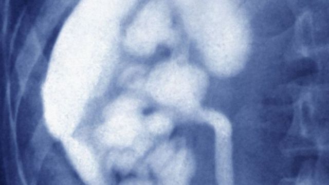 உடல் உறுப்புக்களைத் திருடி விற்ற நபர்