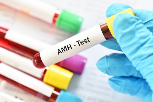 Mão com luva segurando frasco com amostra de sangue com etiqueta escrito AMH - Teste