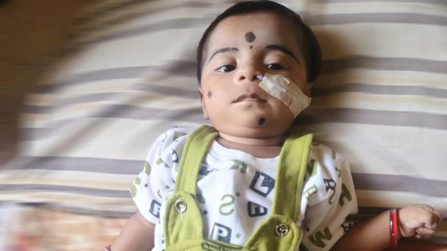 ஊசி விலை ரூ.17 கோடி