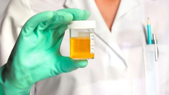 சிறுநீரக நோய்கள்