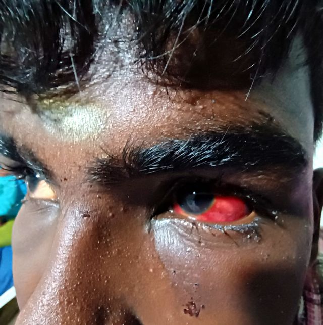 நெல்லை பட்டியலின இளைஞர்கள் தாக்கப்பட்ட விவகாரம்