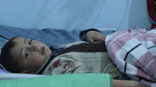 yaralı çocuk