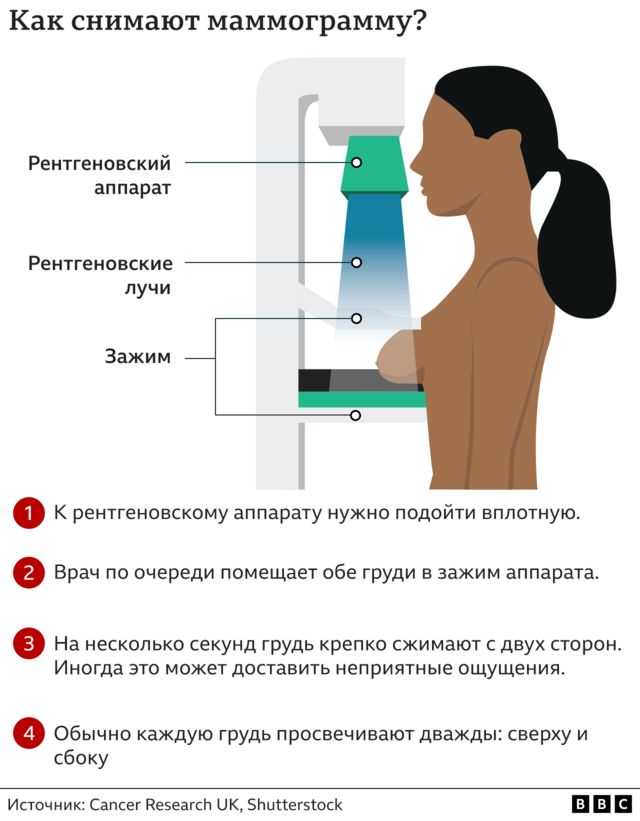 Графика: как делают маммограмму