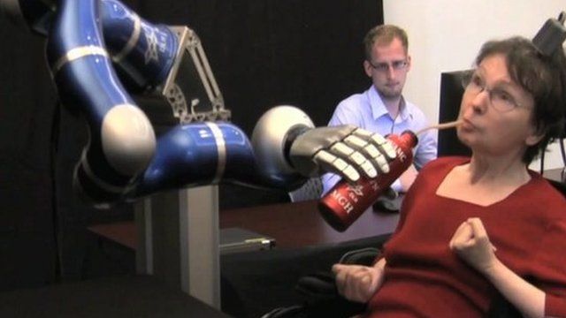 Robotic arm controlled by patient's brain