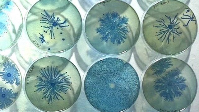 Bacteria growth patterns on display