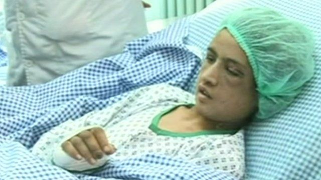 Sahar Gul in a hospital in Kabul