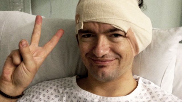 William Mager in hospital post surgery with bandage round his head. He is making a peace sign.