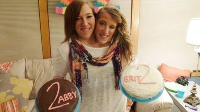 Conjoined twins Abby and Brittany Hensel the chances of survival