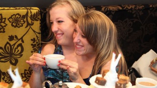 Amazing story of conjoined twins Abigail and Brittany Hensel