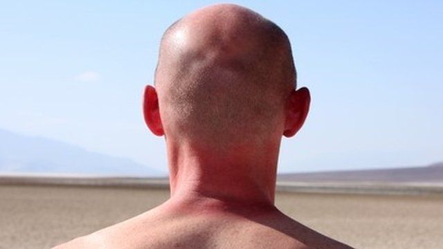 Head and shoulders of man from the back