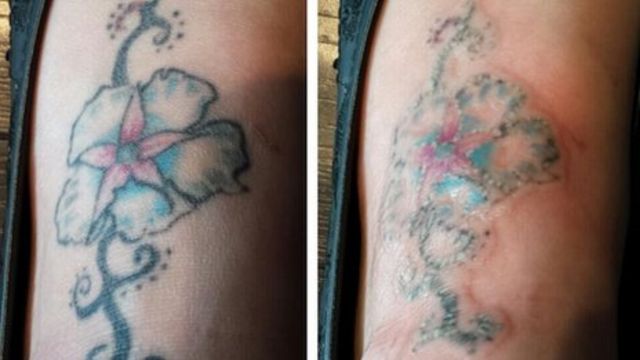 Lose the Weight But Not the Humor  Ugliest Tattoos  funny tattoos  bad  tattoos  horrible tattoos  tattoo fail