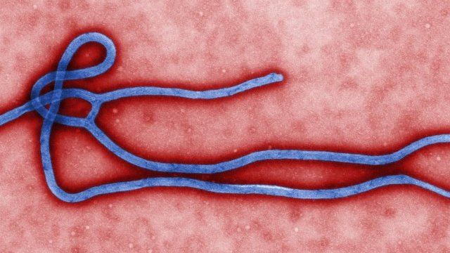An electron microscope image of the Ebola virus