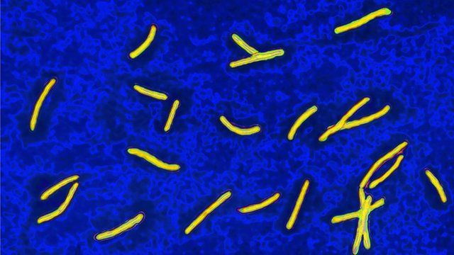Mycobacterium Tuberculosis microscope image