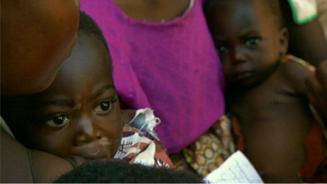 Malawian child in need of medical aid