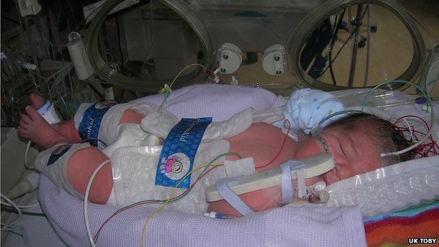 Babies at risk of developing brain damage after suffering low oxygen levels at birth are given the treatment