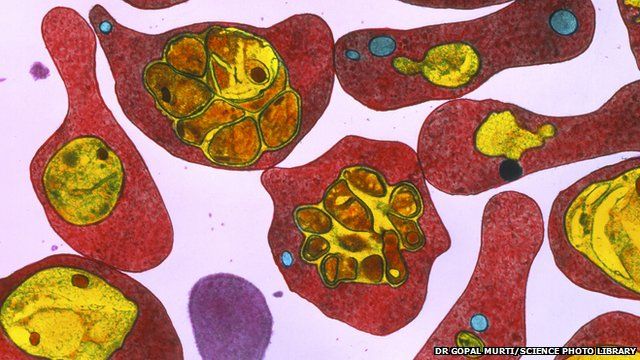 Malaria infected red blood cells