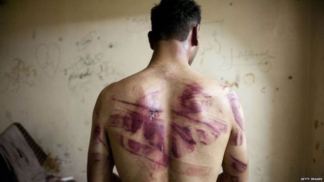 シリアの虐待被害者