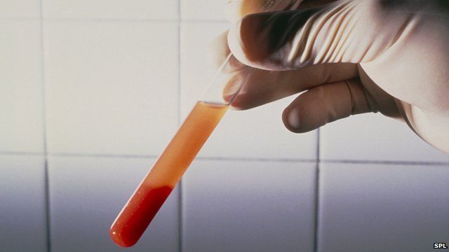 Blood is screened for diseases before it is transfused
