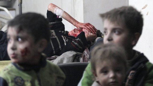 Injured children rest in a field hospital near Damascus on January 25, 2015