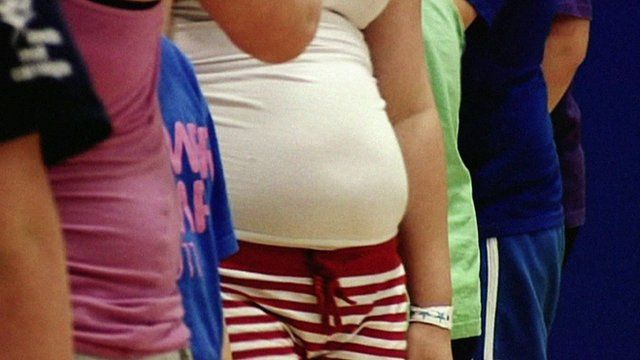 Anonymous shots of obese children's stomachs