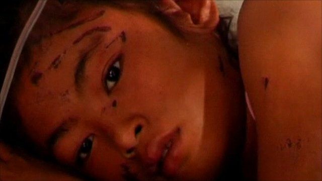 Young child on a drip