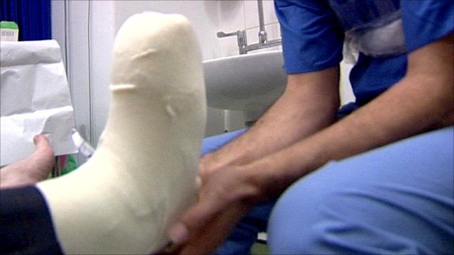 Bandaged foot