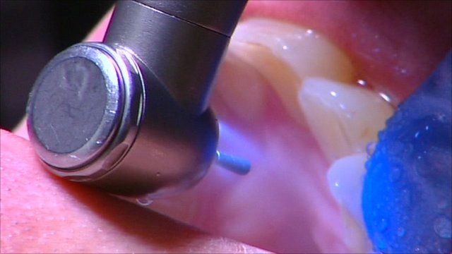 Dentist Drill Sound Cancelled Out By Device Bbc News