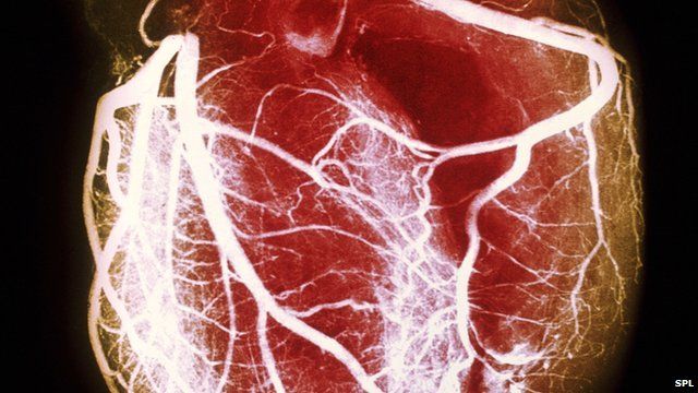 healthy heart