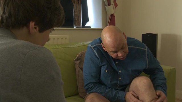 Former postman shows dog attack injuries