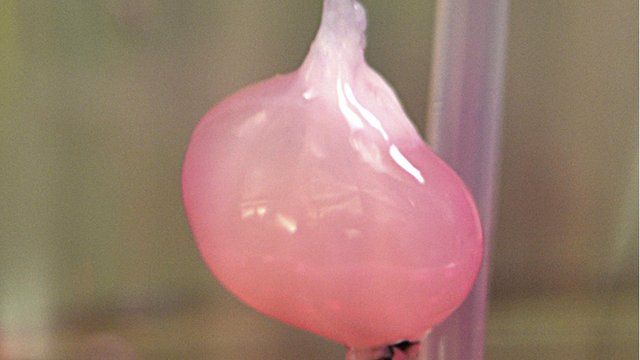 artificial-kidney-transplants-in-five-years-bbc-news