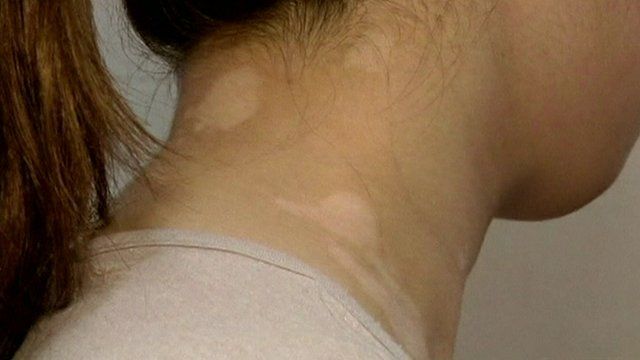 Kanebo Apologises For Lightening Products Skin Damage BBC News