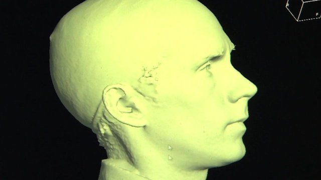 Defining the most 'normal' shape of a human skull - BBC News