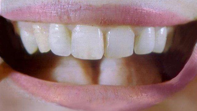 An open mouth