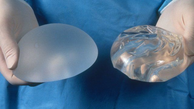 Breast implants