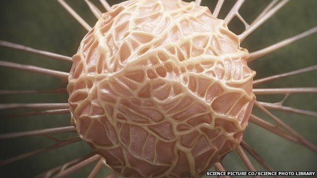 Breast cancer cell