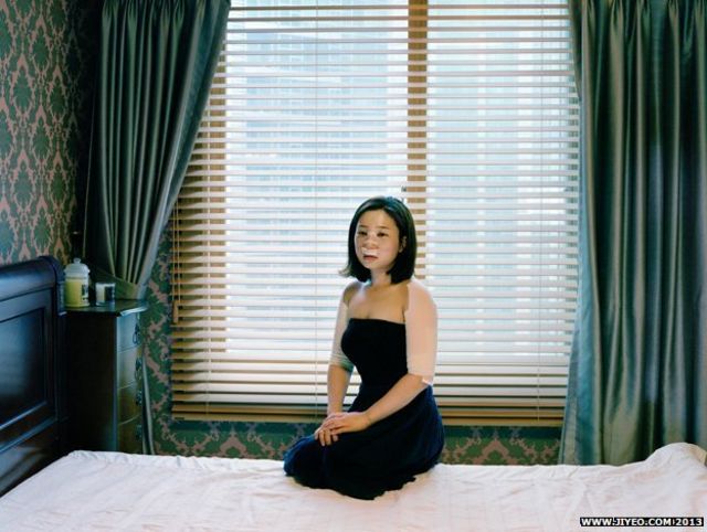 Victims of a craze for cosmetic surgery