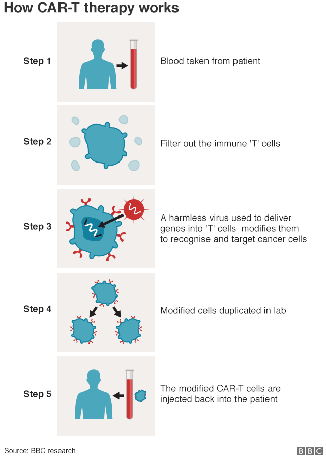 Infographic explaining how CAR-t works