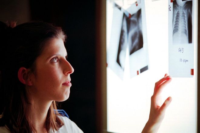Медсестра Лиза Робертс осматривает рентгеновские снимки на световом ящике в детском отделении особого ухода в Университетской больнице Уэльса, Кардифф.